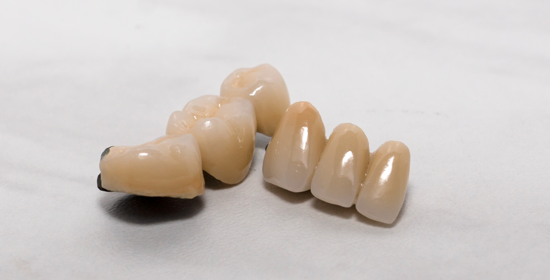 PFM, porcelain fused to metal, crown and bridge work, precious semi-precious or non precious dental work