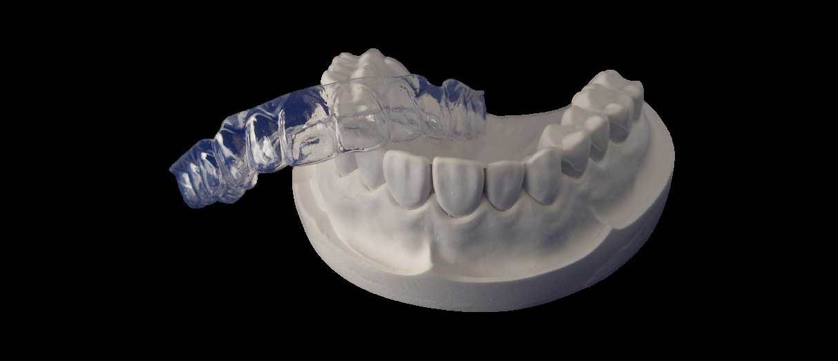 Essix clear removable retainer